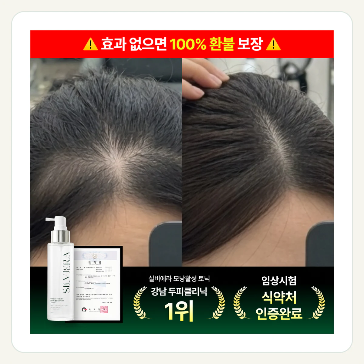 (3종 임상 완료) 실비에라 EGCG 트리니티™ 제품 이미지
